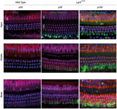 LGR5-Positive Supporting Cells Survive Ototoxic Trauma in the Adult Mouse Cochlea